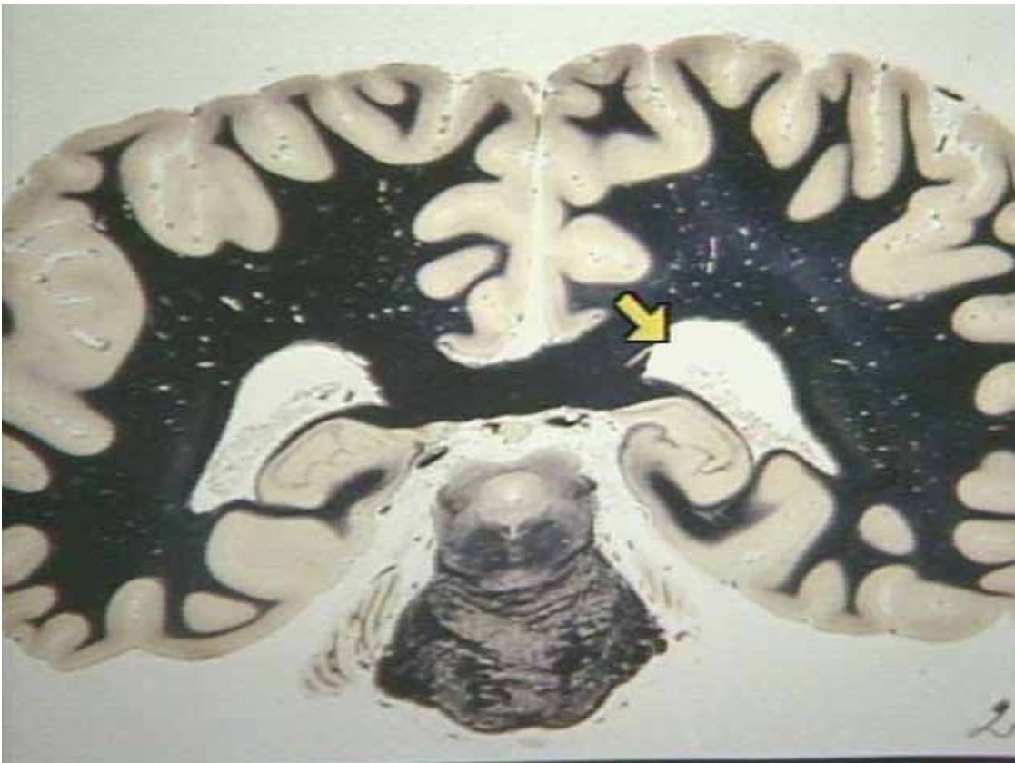 <p>What is the arrow pointing at?</p>