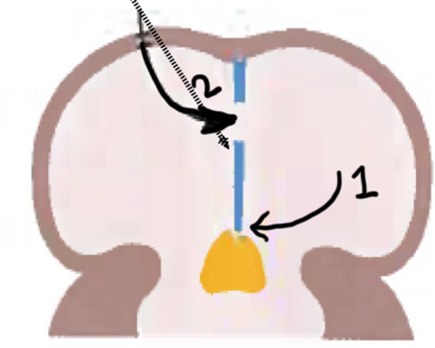 <p>What is 1</p>
