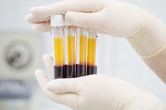 <p>Pale yellow-coloured aqueous solution. It transports:</p><ul><li><p>nutrients (e.g. glucose/amino acids)</p></li><li><p>waste (e.g. urea/lactic acid)</p></li><li><p>hormones &amp; heat</p></li><li><p>proteins (e.g. albumins/antibodies)</p></li></ul><p></p>