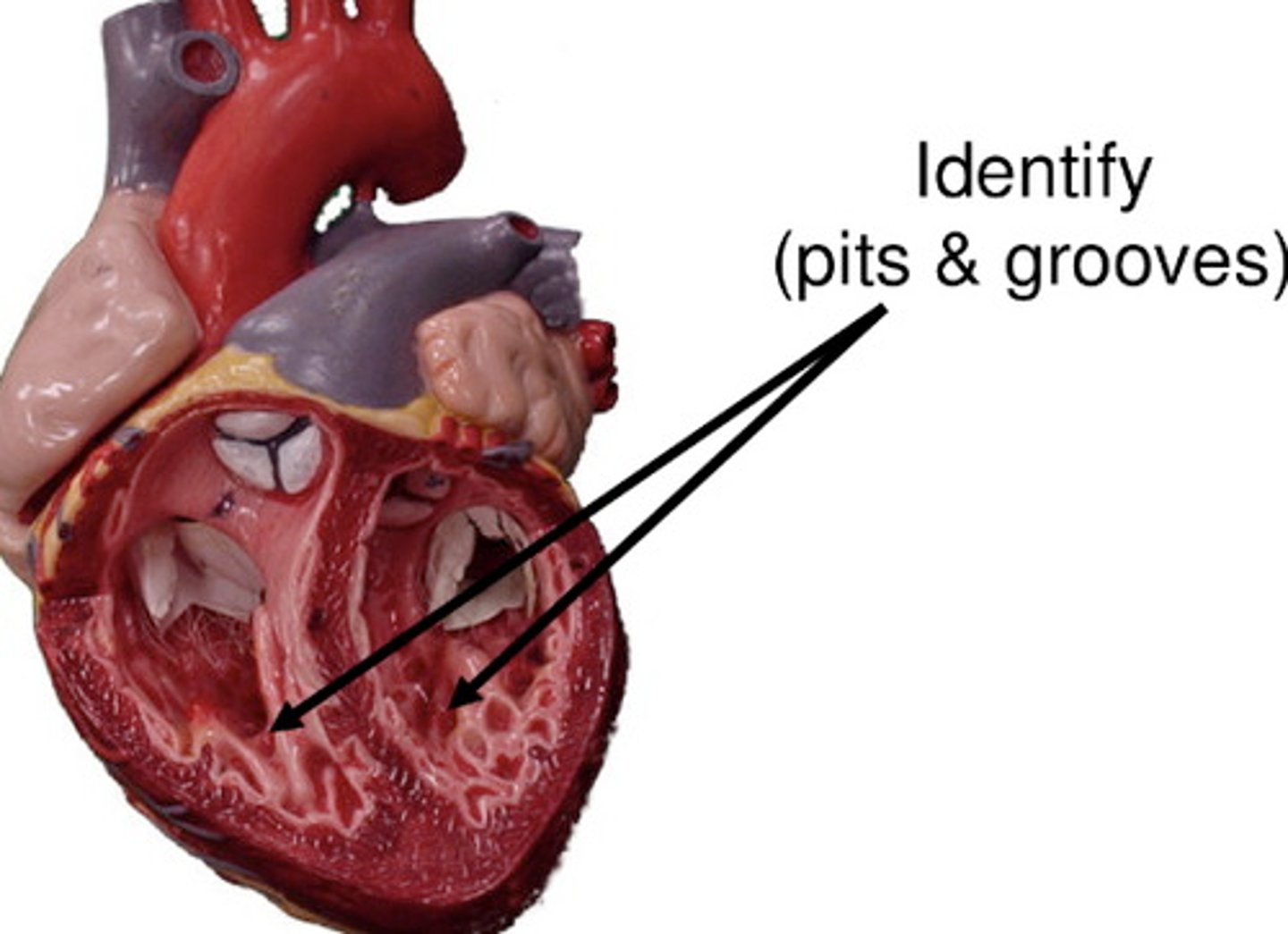 <p>muscular ridges on the internal surface of the ventricles</p>