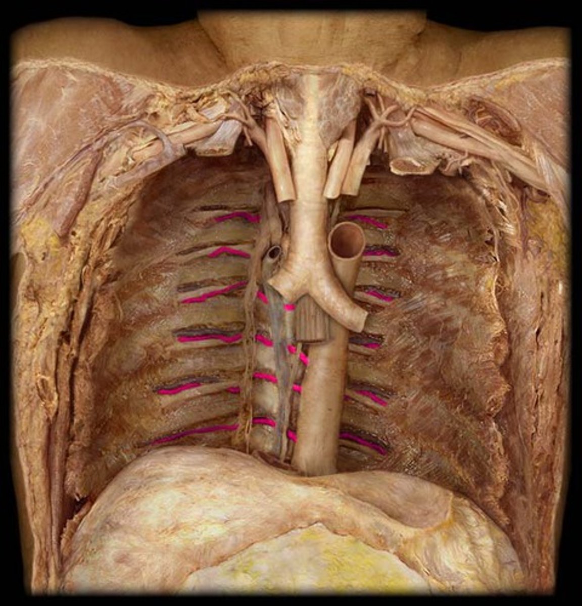 <p>artery</p>