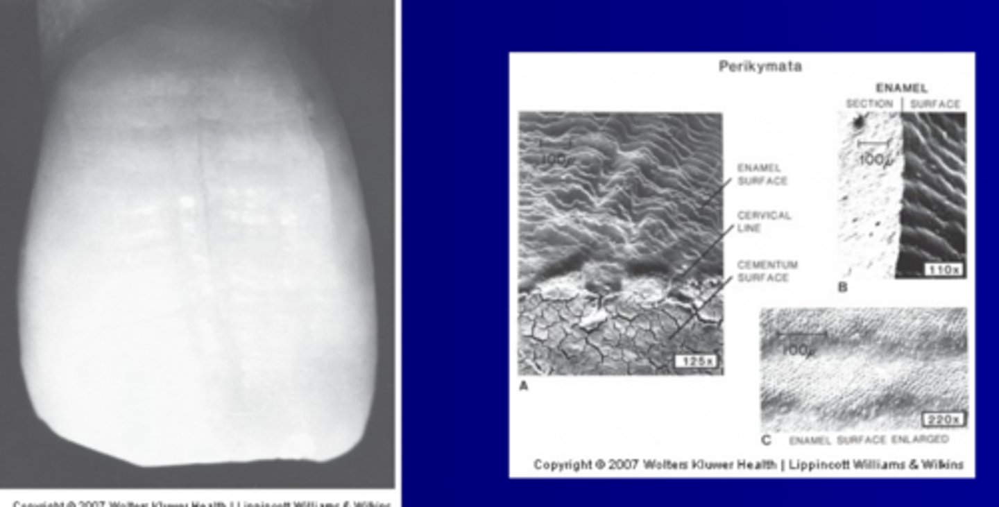 <p>Very small wave-like ripples of enamel on newly erupted teeth</p>