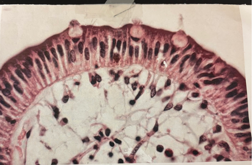 <p>What kind of tissue/cartilage is this?</p>