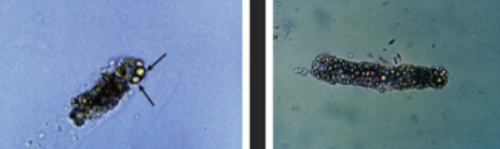 <p>What casts are these? What diseases are associated? </p>