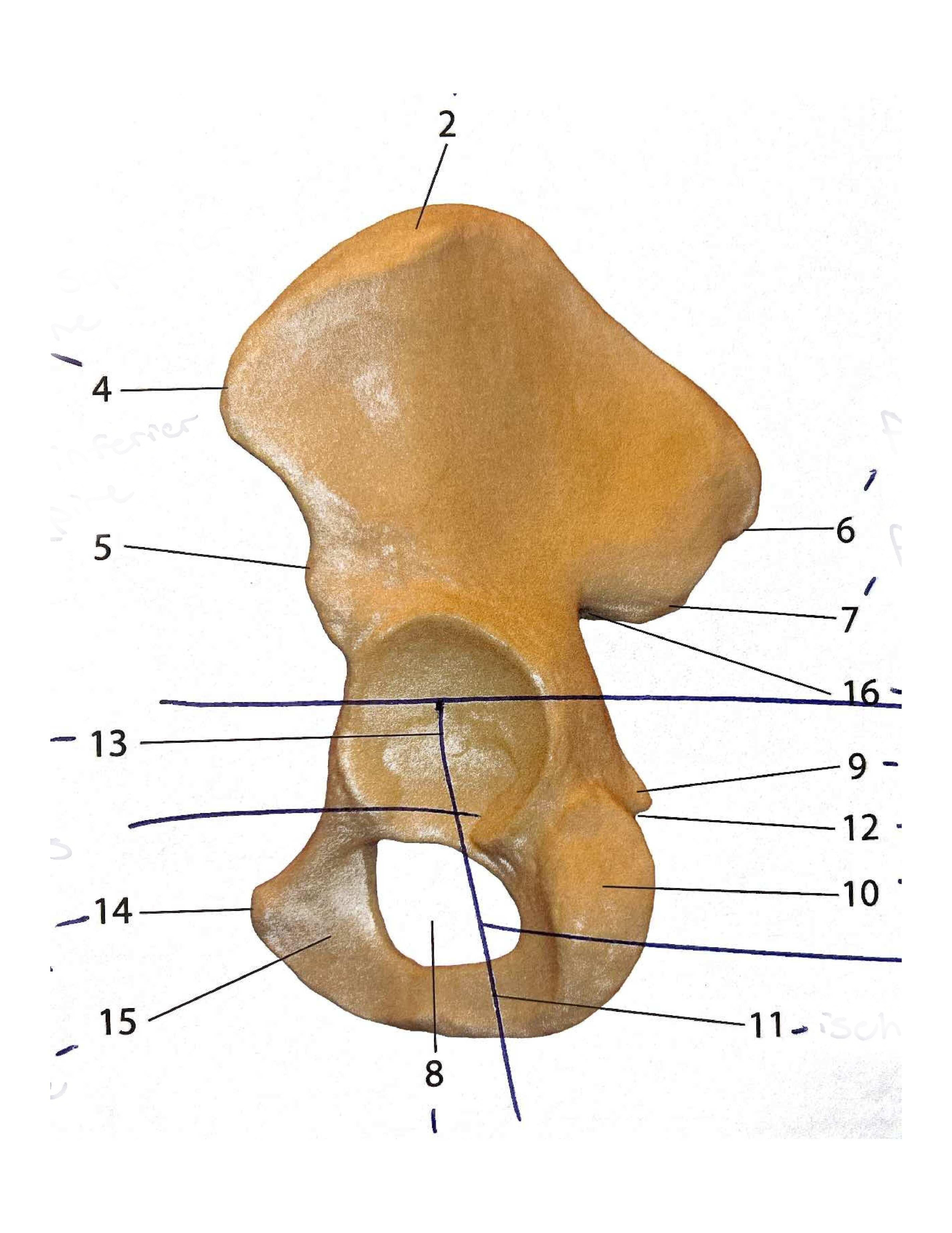 <p>#6</p>