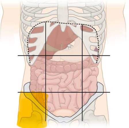 <p>Right iliac</p>