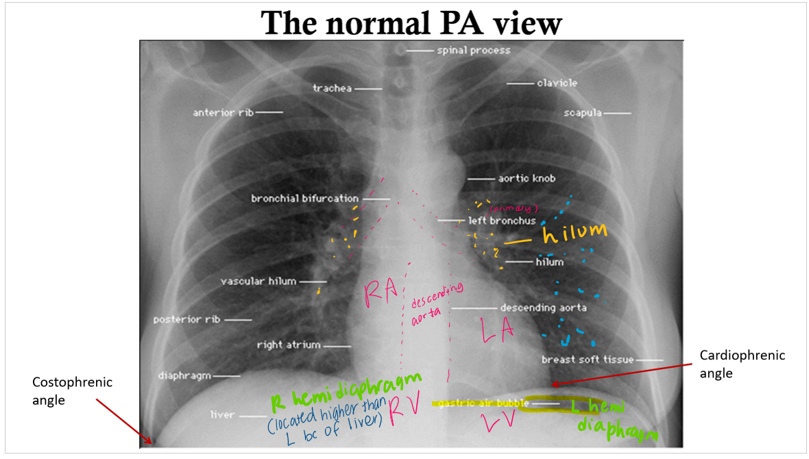 <p>labeled PA view </p>