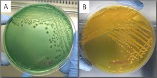 <p>Which TCBS plate has <strong>Vibrio cholerae </strong>and which plate has <strong>Vibrio parahemolyticus</strong>?</p>