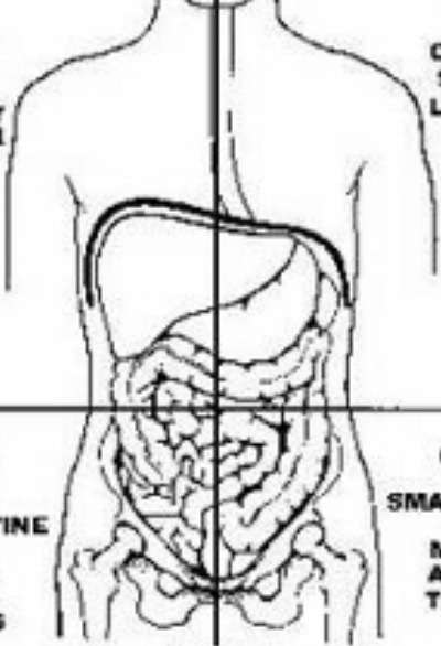 <p>What are the four abdominal quadrants going from left to right in the picture?</p>