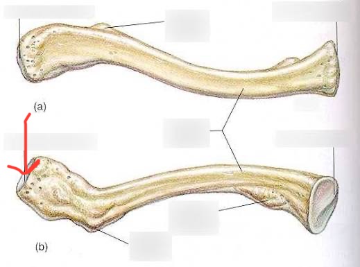 <p>clavicle, lateral end, meets with scapula</p>