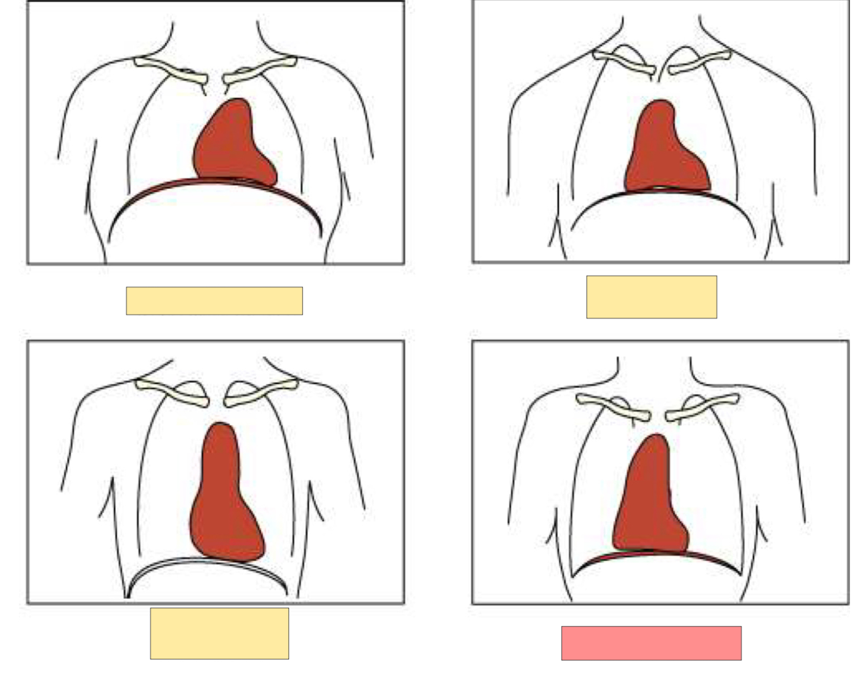 <p>What body habitus is this?</p>