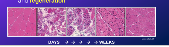 <p>-severe muscle damage can result from excessive exercise intensity, physical trauma (impact or tearing), surgery…</p><p>-within a few weeks, muscle will return to (mostly) normal</p><p>-if we look at muscle images taken form days to weeks, we see intact fibres, then pretty intense damage with white (neutrophils), and then recovery with many more nuclei (first in centre and then move to periphery)</p><p>- the overall repair process involves tissue degeneration and regeneration</p>