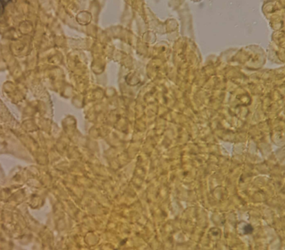 <p>Hemitrichia serpula </p><p>Gr.: MYXOMYCOTA </p><p>       Kl.: Myxomycetes</p>