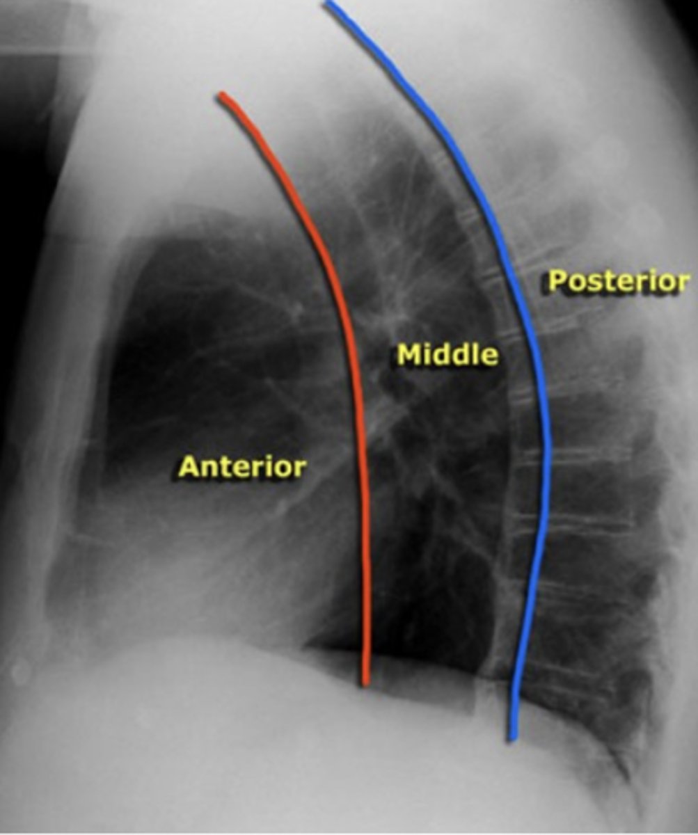 <p>What structures are located in the anterior mediastinal compartment?</p>