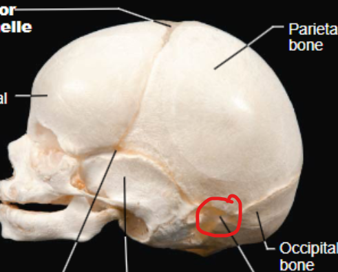<p>Located on each side of the skull between the temporal, parietal, and occipital bones. It closes shortly after birth.</p>
