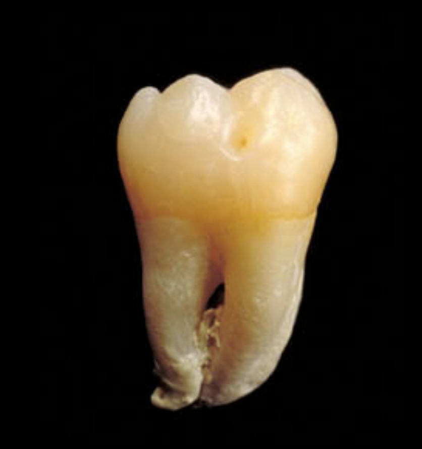 <p>Tooth #, Eruption, and Root Formation</p>