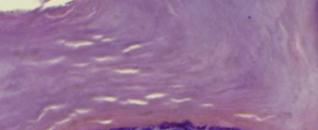 <p>Stratum corneum</p>