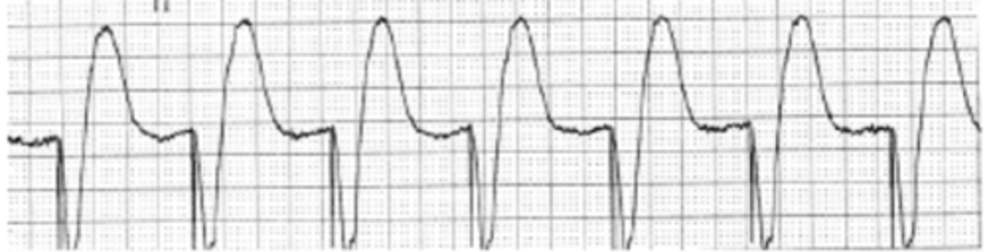 <p>(v) tiếp tục, duy trì, giữ vững</p>