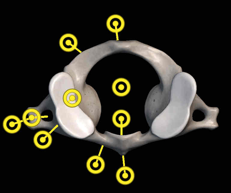 <p>Name this vertebrae</p>