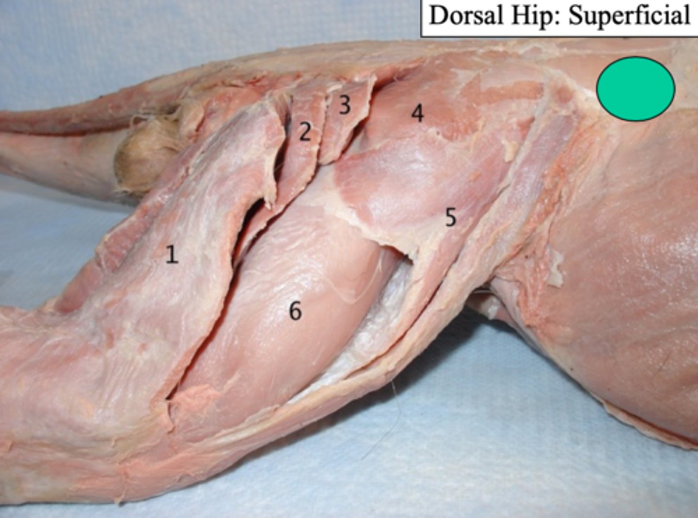 <p>what dorsal hip: superficial muscle is number 1?</p>