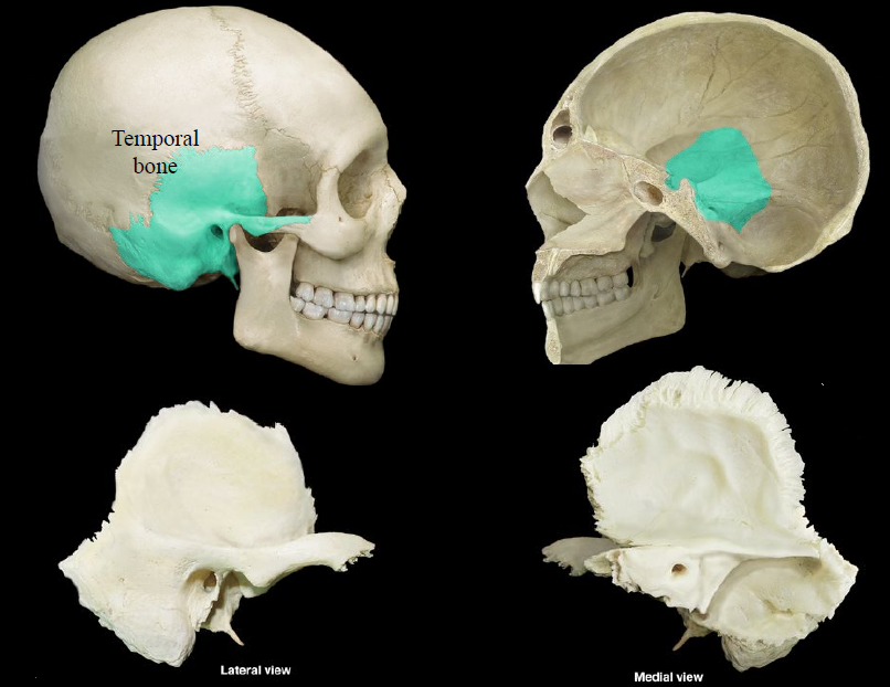 <p>a thick bone forming the side of the human cranium and encasing the inner ear</p>