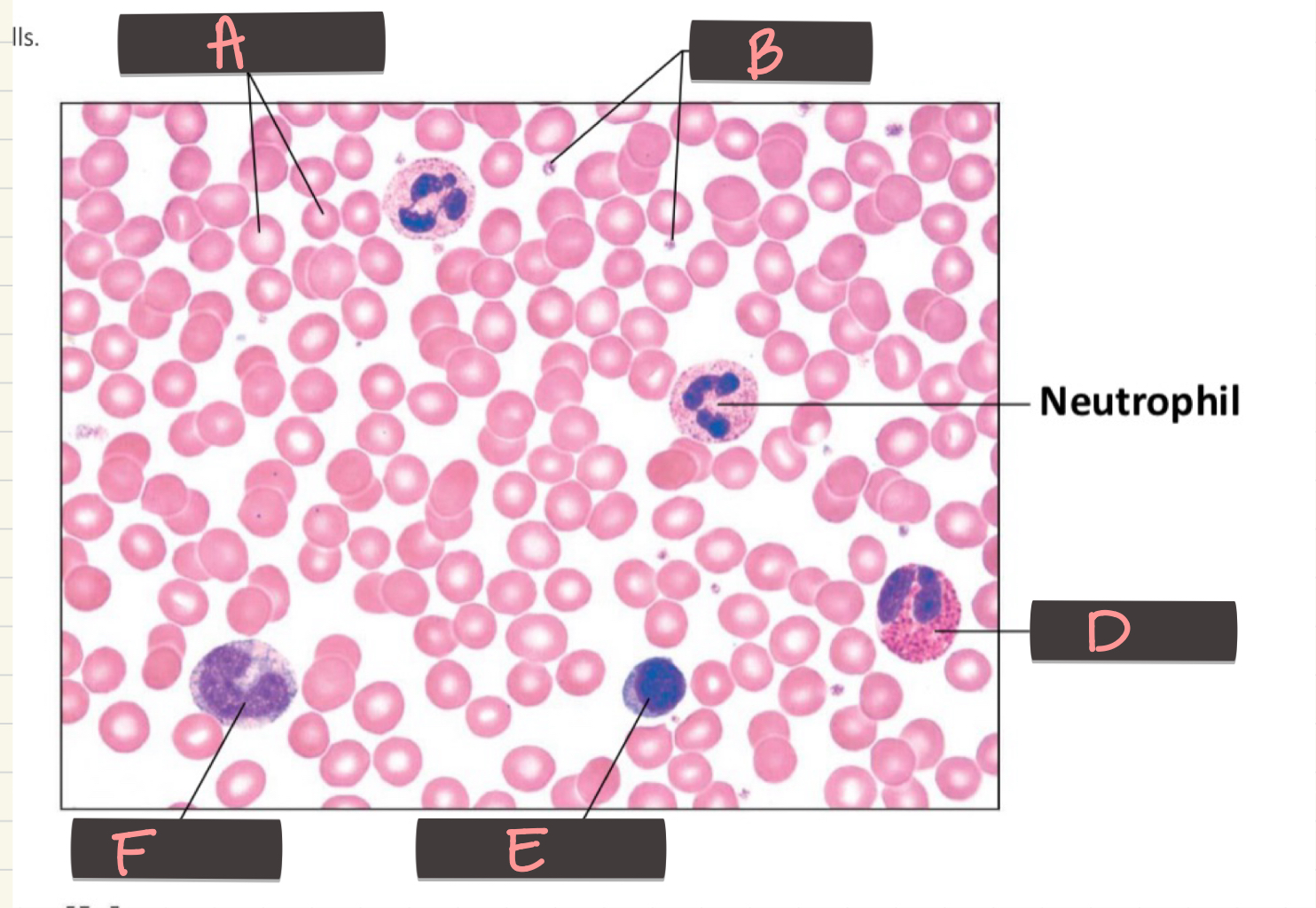<p>Neutrophils</p>