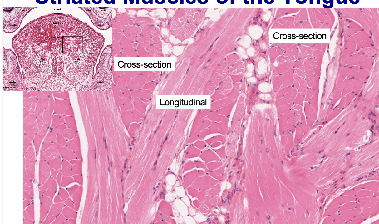 <p>arrangement only found in tongue, heart and stomach: has oblique, transverse and longitudinal sections </p>