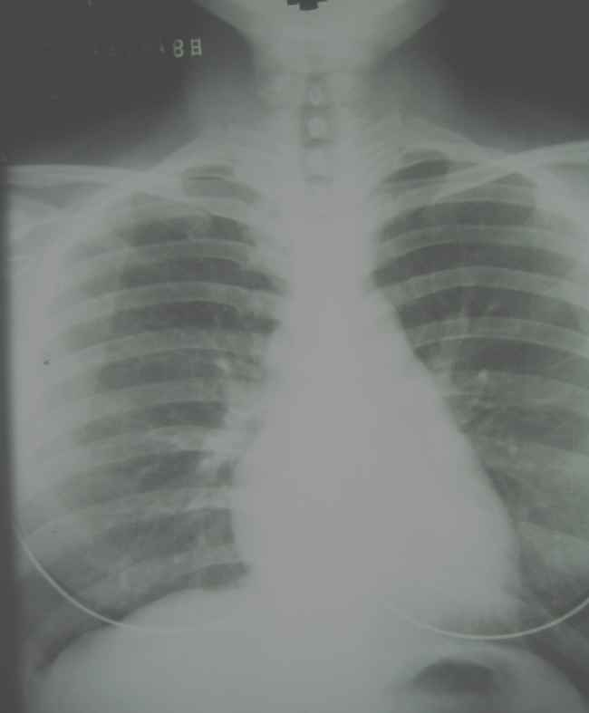 <p>Does this radiograph have high or low contrast?</p>