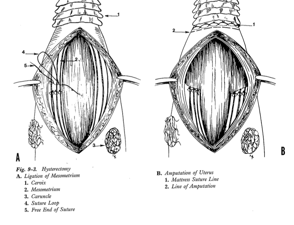 <p>amputation of uterus, open vs closed </p><p>Can use the Callicrate Prolapse Loop (for uterine prolapse) to band and remove </p>