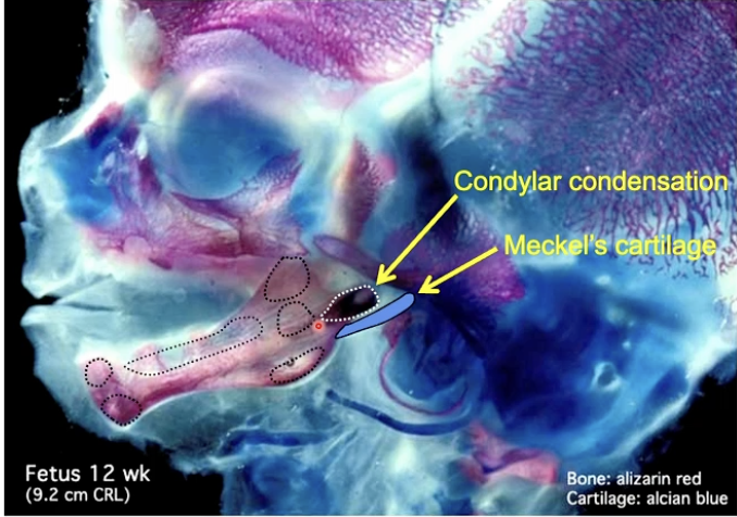 <p><span>What type of ossification occurs in the mesenchymal condensations around Meckel’s cartilage to form the mandible?</span></p>