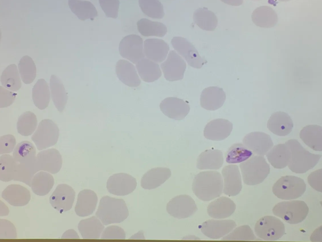 <p>in human blood smear</p>