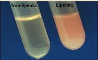 <p>Diagnosis of HypoT4 </p>