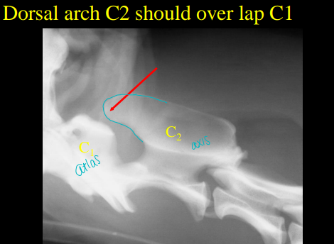 <p>Spinal anatomy </p>