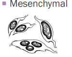 <p>Spindle cell or Mesenchymal tumors</p>