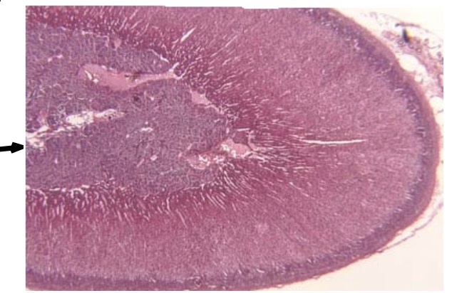 <p>Adrenal Medulla</p>