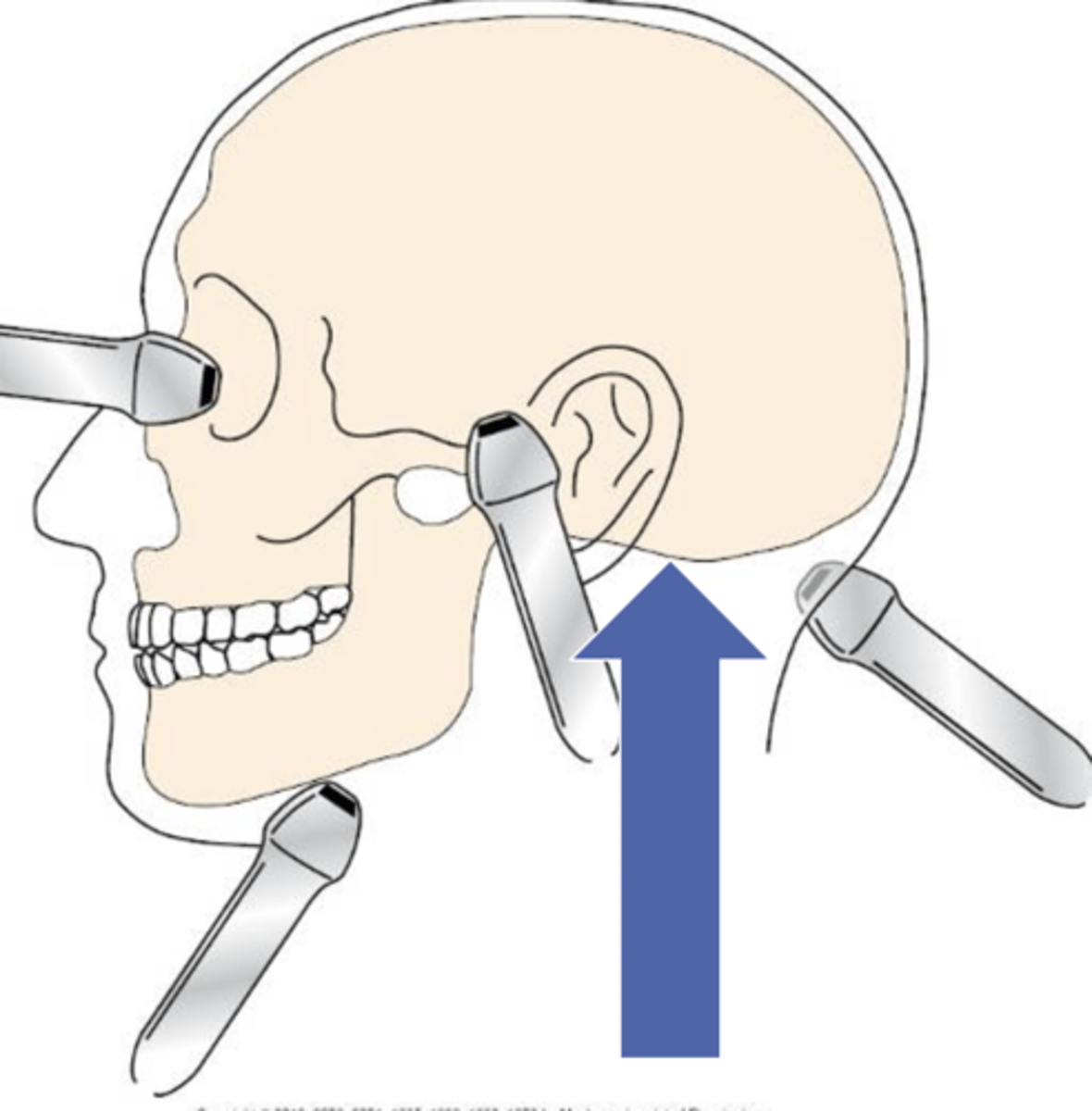 <p>Behind ear between mastoid & sternocleidomastoid muscle</p><p>1.25 cm below mastoid process</p>