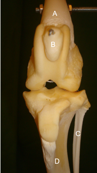 <p>Articulatio femoropatellaris, ledytor?</p>