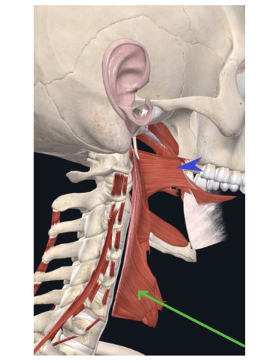 <p>What muscle is the green arrow pointing to?</p>