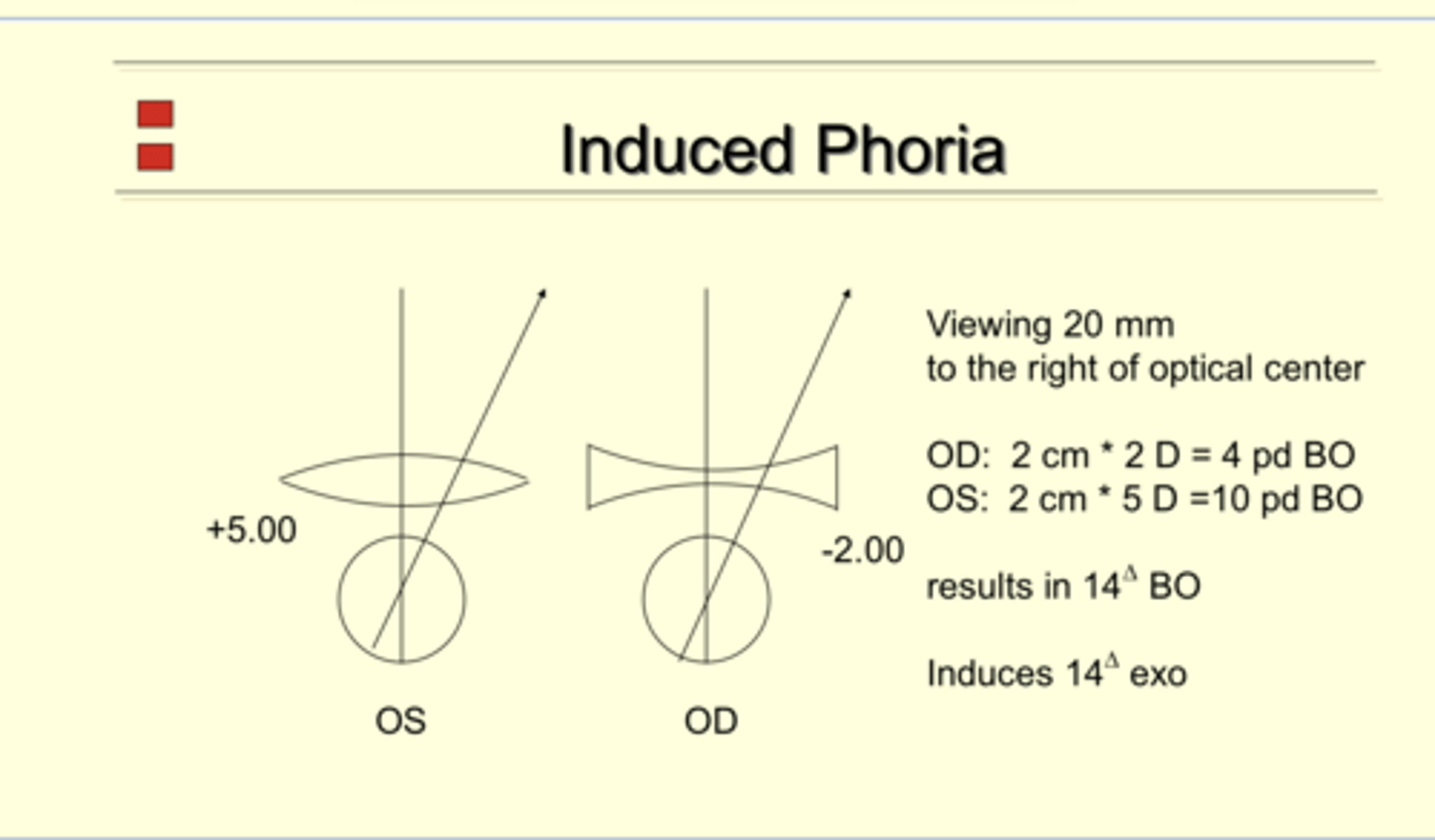 <p>OD: -2.00</p><p>OS: +5.00</p><p>A patient is viewing 20mm from the right to the left of optical center. What is the change in phoria ?</p>