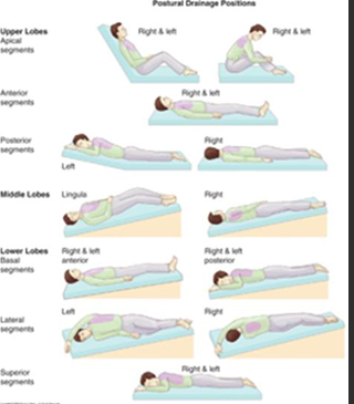 <p>helps clear secretions</p><ul><li><p>percussion=pt must breath slow/deeply, uses fists</p></li><li><p>vibration=done when pt exhales through pursed lips, used instead of percussion if in pain</p></li></ul><p></p>
