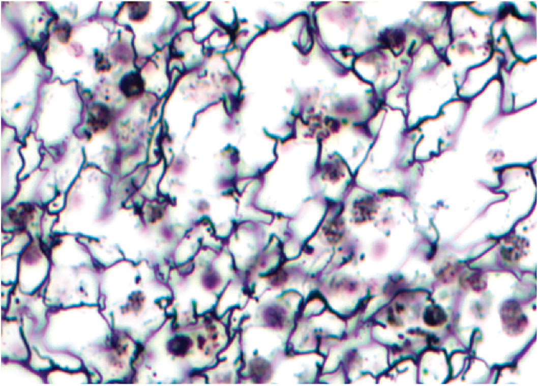 <p><strong>Reticular Tissue</strong></p><p>will</p><p></p>