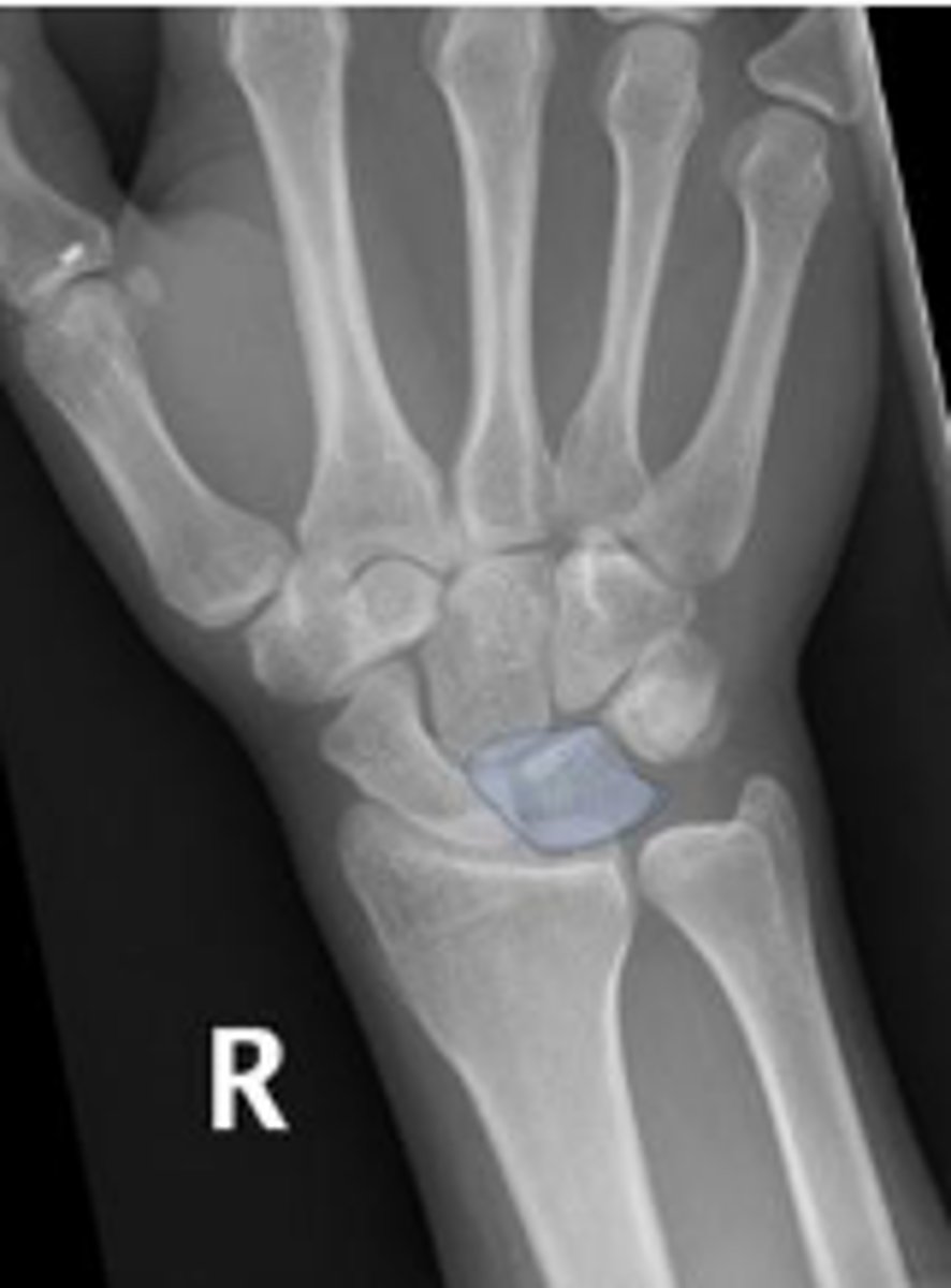 <p>What is outlined?</p>