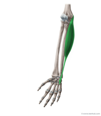<p>Flexor Carpi Ulnaris</p>