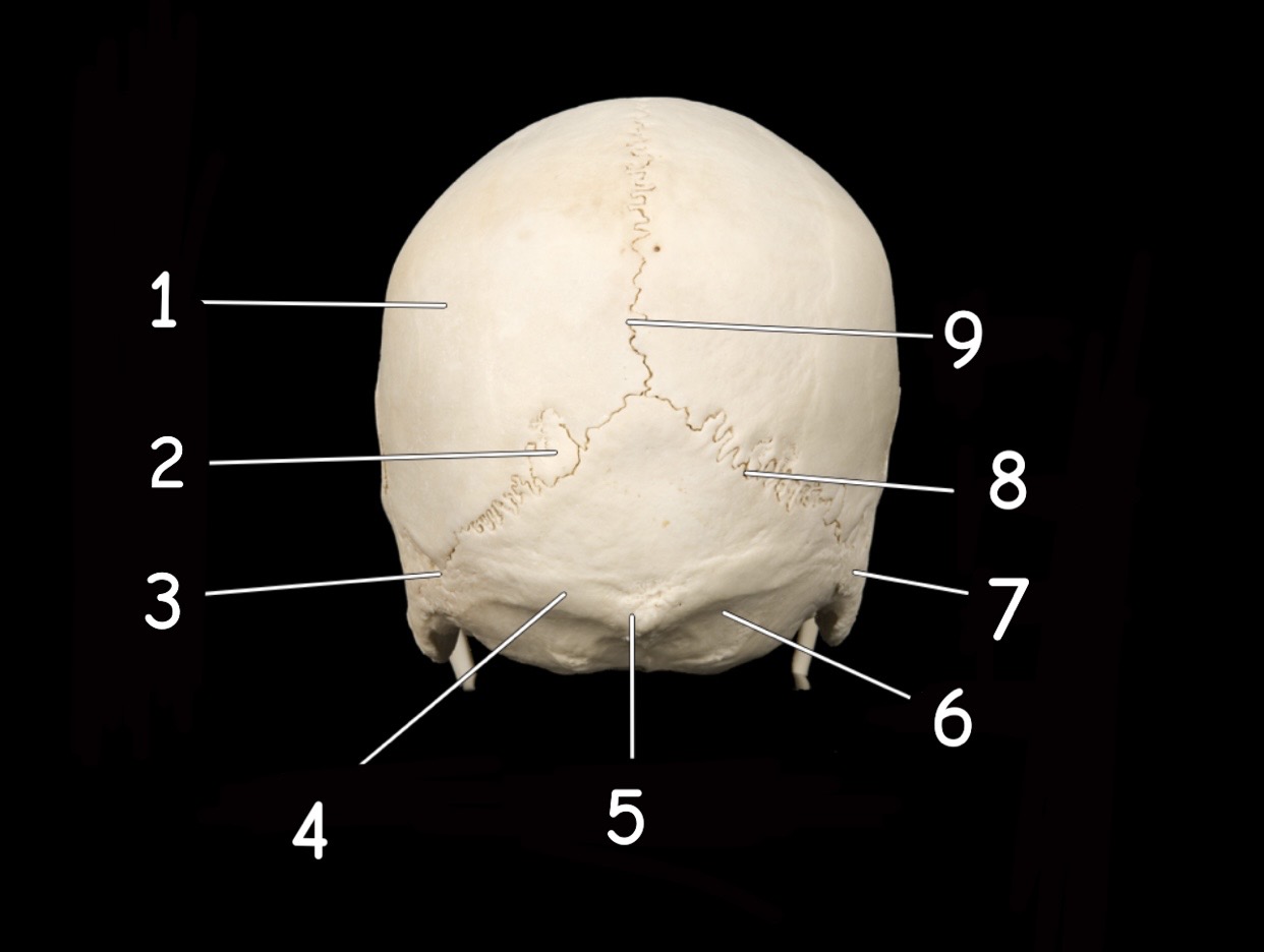 term image