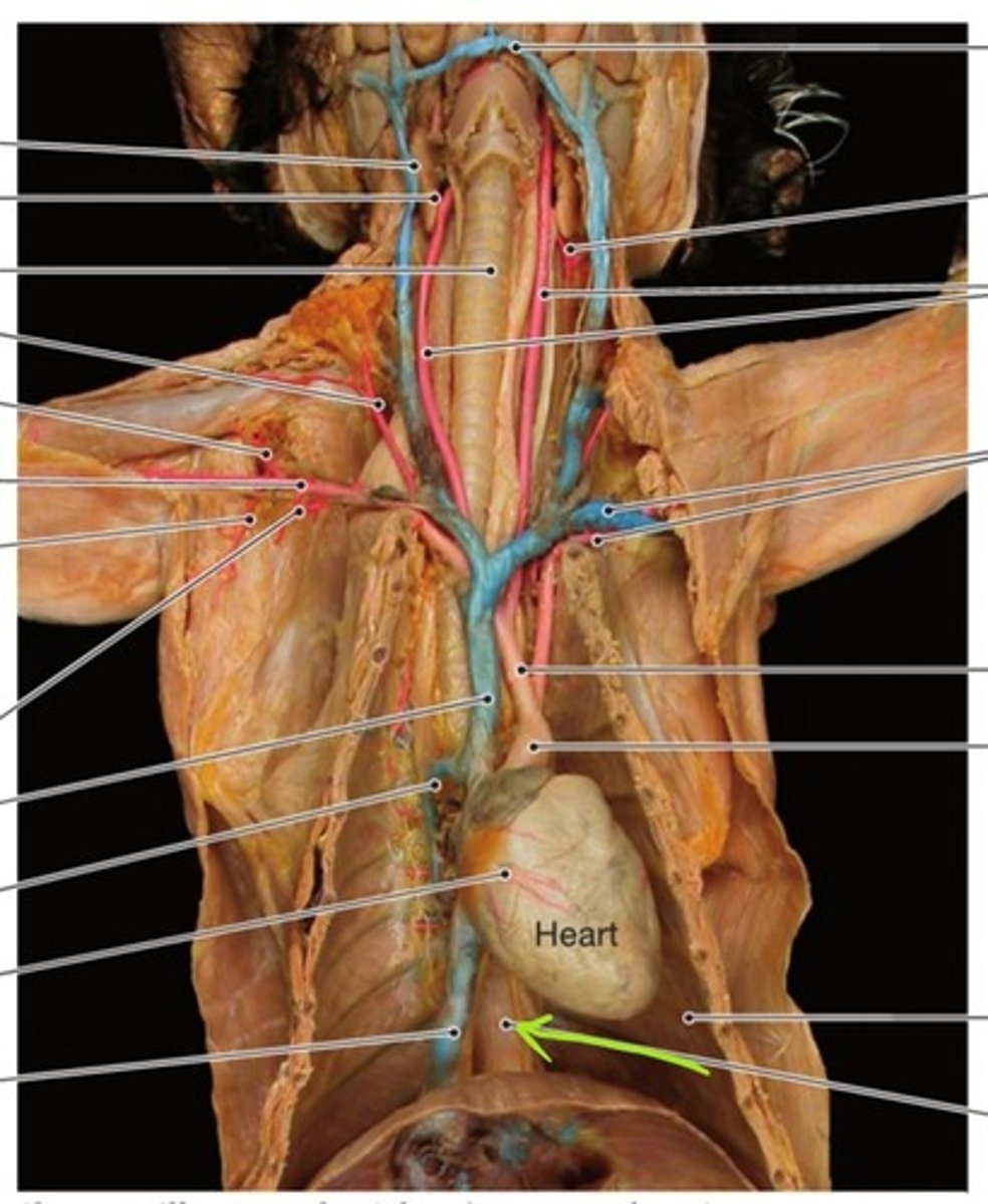 <p>identify this artery</p>