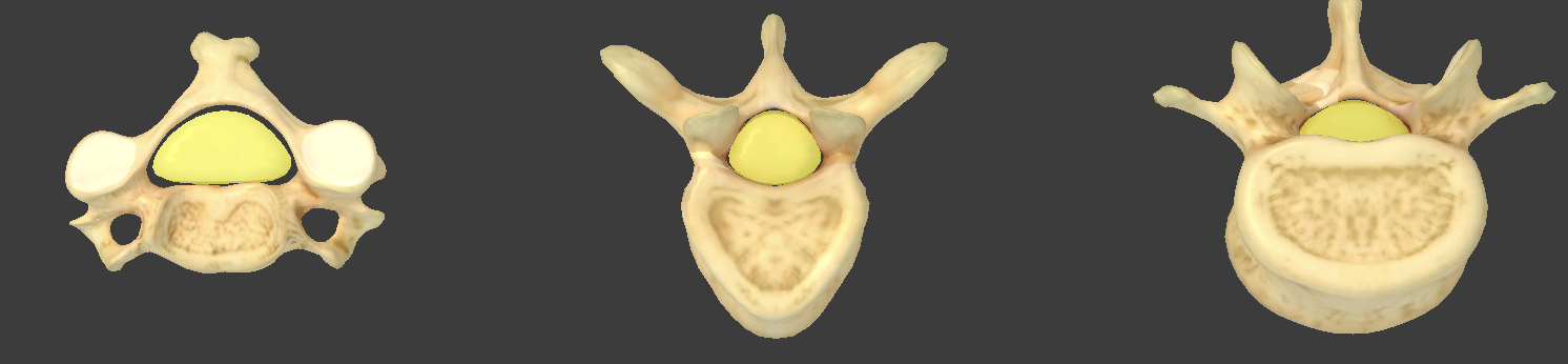 <p>vertebral arch and body enclose this</p>