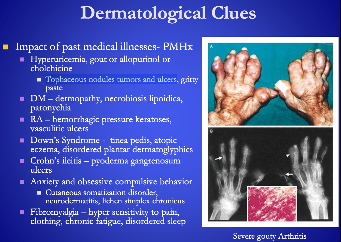 <p><span>Past medical history of <strong>[of what might suggest the following?]</strong>&nbsp;</span></p><ul><li><p>pyoderma gangrenosum ulcers&nbsp;</p></li></ul><p></p>