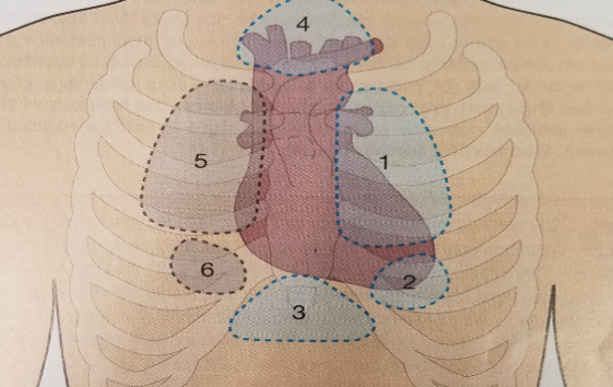 <p>Which of the following window is Apical Window?</p>