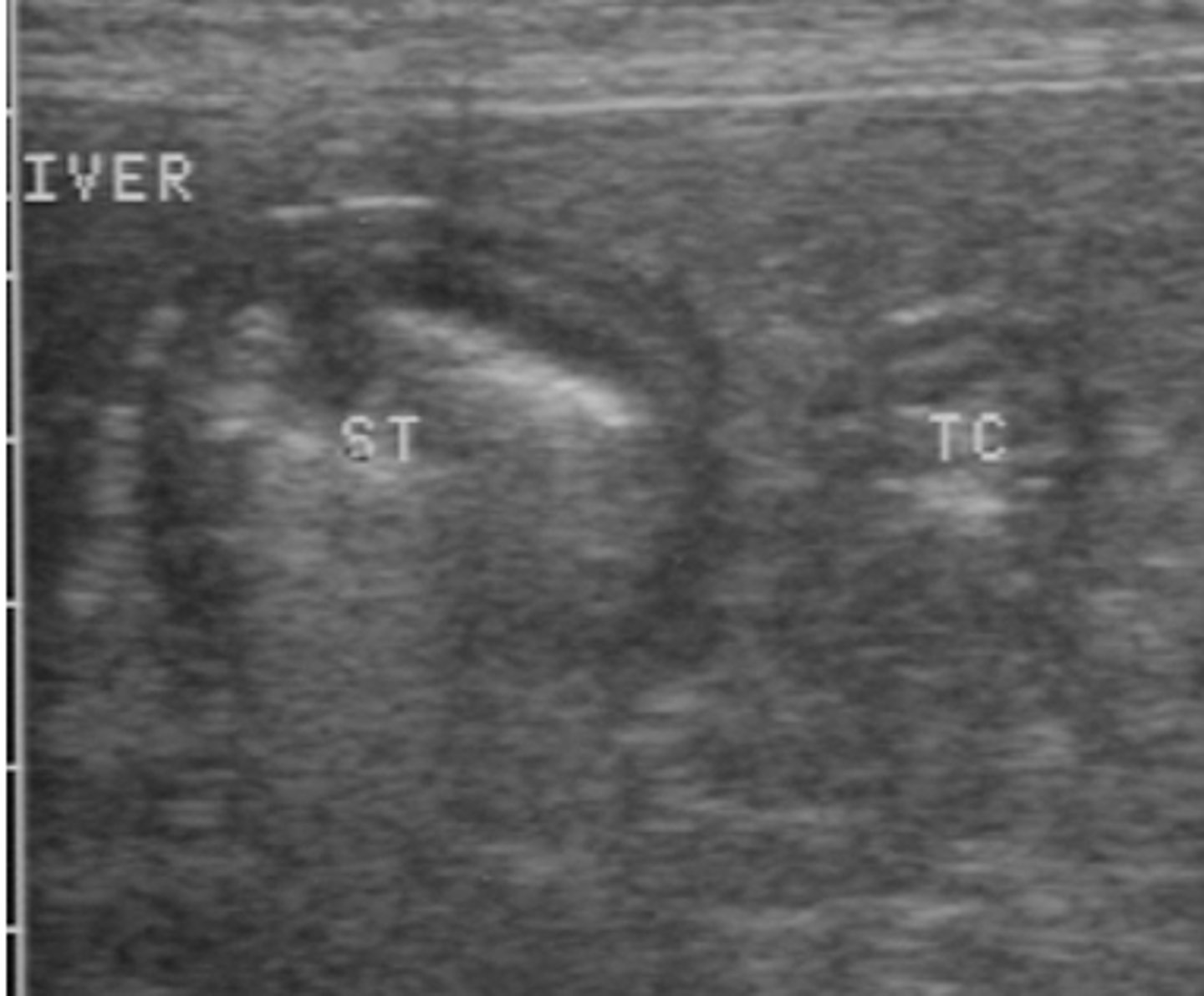 <p>what are the two gastric structures?</p>