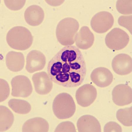 <p>What is this neutrophil showing?</p>